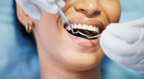 Best Teeth Whitening  in Port Edwards, WI